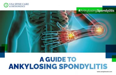 Ankylosing-Spondylitis